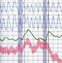 website photo polygraph chart
